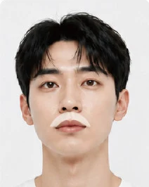 남성 레이저 제모 인중 부위 표시 사진