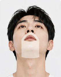 남성 레이저 제모 좁은수염 부위 표시 사진